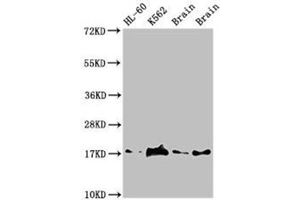 UBE2V2 Antikörper  (AA 2-145)