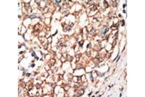 Immunohistochemistry (IHC) image for anti-Bone Morphogenetic Protein Receptor, Type IB (BMPR1B) (AA 472-502) antibody (ABIN3030191)