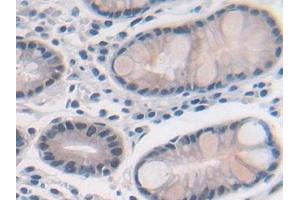 Immunohistochemistry (IHC) image for anti-Methionine Adenosyltransferase II, alpha (MAT2A) (AA 176-395) antibody (ABIN7436291)