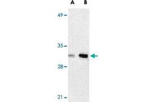 Western blot analysis of ANP32A expression in human Raji cell lysate with ANP32A polyclonal antibody  at 2 ug/mL (lane A) and 4 ug/mL (lane B), respectively. (PHAP1 抗体  (C-Term))