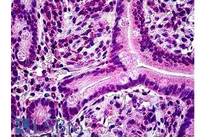 Immunohistochemistry (IHC) image for anti-Tyrosine-Protein Phosphatase Non-Receptor Type 22 (PTPN22) (Internal Region) antibody (ABIN6391380)