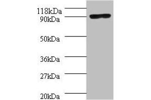 Western blot All lanes: Aquaticus DNA polymerase I, thermostable antibody at 2 μg/mL + 293T whole cell lysate Secondary Goat polyclonal to rabbit IgG at 1/10000 dilution Predicted band size: 94 kDa Observed band size: 94 kDa (POLA1 抗体  (AA 310-832))