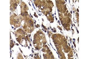 Immunohistochemistry of paraffin-embedded Human stomach using STAMBP Polyclonal Antibody at dilution of 1:100 (40x lens). (STAMBP 抗体)