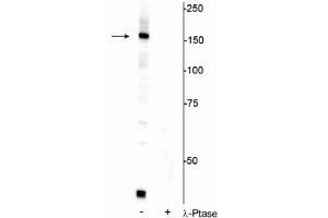 Western blot of HeLa cell lysate showing specific immunolabeling of the ~150 kDa FANCI protein phosphorylated at Ser556 in the first lane (-). (FANCI 抗体  (pSer556))