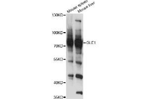 Western blot analysis of extracts of various cell lines, using GLE1 antibody (ABIN6293108) at 1:3000 dilution. (GLE1 抗体)
