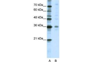 Western Blotting (WB) image for anti-Mediator Complex Subunit 27 (MED27) antibody (ABIN2461720) (MED27 抗体)