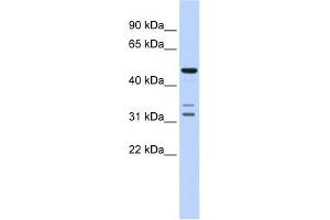 HTRA4 antibody used at 1 ug/ml to detect target protein.