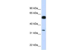 WB Suggested Anti-C19orf62 Antibody Titration: 0. (BRISC and BRCA1 A Complex Member 1 (BABAM1) (N-Term) 抗体)