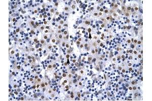G22P1 antibody was used for immunohistochemistry at a concentration of 4-8 ug/ml to stain Hepatocytes arrows) in Human Liver. (XRCC6 抗体  (N-Term))