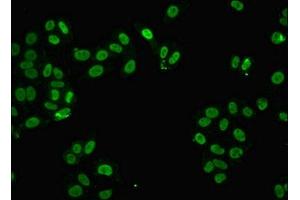 Immunofluorescent analysis of HepG2 cells using ABIN7168366 at dilution of 1:100 and Alexa Fluor 488-congugated AffiniPure Goat Anti-Rabbit IgG(H+L) (FUS 抗体  (AA 1-198))