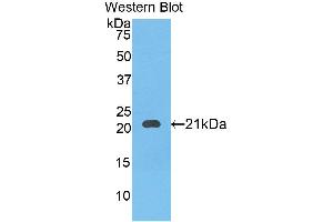 Western blot analysis of the recombinant protein. (SERPINB4 抗体  (AA 60-222))