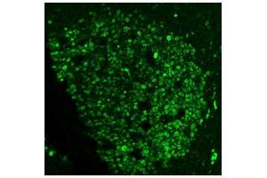 IF analysis of Ki67 using anti-Ki67 antibody (ABIN7601100).