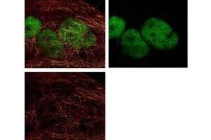 Immunofluorescence (IF) image for Goat anti-Mouse IgG (Heavy & Light Chain) antibody (Atto 425) - Preadsorbed (ABIN964954) (山羊 anti-小鼠 IgG (Heavy & Light Chain) Antibody (Atto 425) - Preadsorbed)