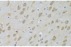 Immunohistochemistry of paraffin-embedded Mouse brain using ADRBK2 Polyclonal Antibody at dilution of 1:100 (40x lens). (ADRBK2 抗体)