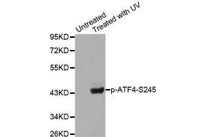 Western blot analysis of extracts from Hela cells using Phospho-ATF4-S245 antibody.