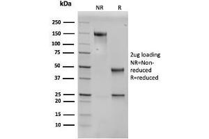 SDS-PAGE Analysis Purified PAI-RBP1 Mouse Monoclonal Antibody (SERBP1/3496). (SERBP1 抗体  (AA 3-139))