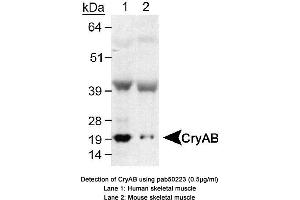 Image no. 1 for anti-Crystallin, alpha B (CRYAB) (AA 100-175), (Internal Region) antibody (ABIN363532) (CRYAB 抗体  (Internal Region))