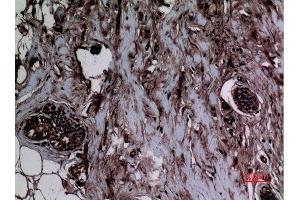 Immunohistochemistry (IHC) analysis of paraffin-embedded Human Breast, antibody was diluted at 1:100. (Histone 3 抗体  (meLys5))