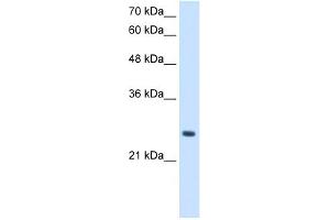 WB Suggested Anti-PPCDC Antibody Titration:  2. (PPCDC 抗体  (N-Term))