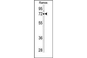 Image no. 1 for anti-Arachidonate 15-Lipoxygenase (ALOX15) (C-Term) antibody (ABIN360266) (ALOX15 抗体  (C-Term))