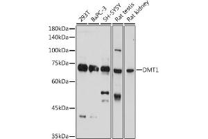Western Blotting (WB) image for anti-Solute Carrier Family 11 (Proton-Coupled Divalent Metal Ion Transporters), Member 2 (SLC11A2) (AA 1-100) antibody (ABIN6147839)