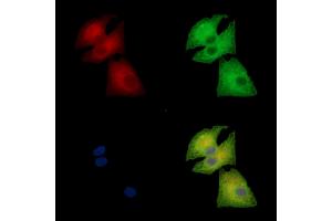 ABIN7095188 and ABIN7099244 staining  cells by IF/ICC.