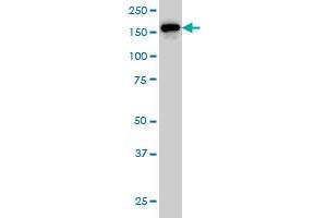 ROCK2 monoclonal antibody (M01), clone 2A4 Western Blot analysis of ROCK2 expression in HeLa . (ROCK2 抗体  (AA 1279-1388))