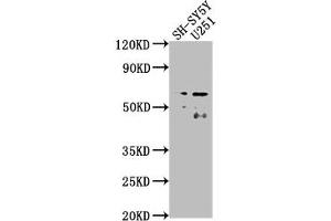 Western Blot Positive WB detected in: SH-SY5Y whole cell lysate, U251 whole cell lysate All lanes: CSRNP3 antibody at 1:2000 Secondary Goat polyclonal to rabbit IgG at 1/50000 dilution Predicted band size: 65, 59 kDa Observed band size: 65 kDa
