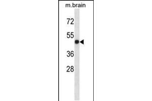 Western blot analysis in mouse brain tissue lysates (35ug/lane).