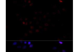 Immunofluorescence analysis of HeLa cells using TBP Polyclonal Antibody at dilution of 1:100 (40x lens). (TBP 抗体)