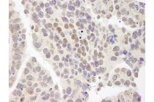 Immunohistochemistry (IHC) image for anti-Zinc Finger Protein 261 (ZMYM3) (AA 250-300) antibody (ABIN7448881) (ZMYM3 抗体  (AA 250-300))