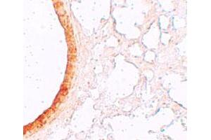 Immunohistochemical staining of mouse lung cells with SLC39A3 polyclonal antibody  at 5 ug/mL.