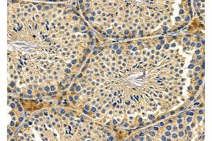 ABIN6259699 and ABIN6279056 at 1/100 staining Mouse testis tissue by IHC-P. (ABHD13 抗体  (Internal Region))