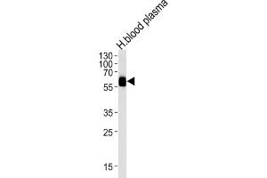 Western Blotting (WB) image for anti-serpin Peptidase Inhibitor, Clade A (Alpha-1 Antiproteinase, Antitrypsin), Member 3 (SERPINA3) antibody (ABIN3003133)