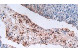 Immunohistochemistry (IHC) image for anti-Defensin, alpha 3, Neutrophil-Specific (DEFa3) (AA 21-94) antibody (ABIN7439243)