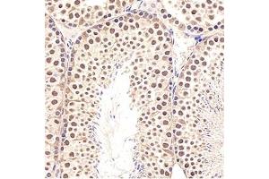 Immunohistochemistry analysis of paraffin-embedded mouse testis using,GTF2F2 (ABIN7074036)at dilution of 1: 3000 (GTF2F2 抗体)