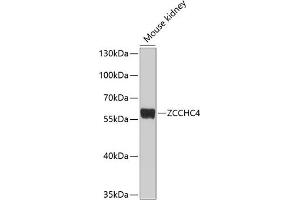 Western blot analysis of extracts of mouse kidney, using ZCCHC4 antibody (ABIN6133077, ABIN6150408, ABIN6150409 and ABIN6214292) at 1:1000 dilution.