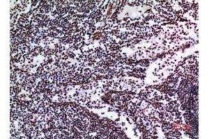 Immunohistochemistry (IHC) analysis of paraffin-embedded Human Lymph Gland, antibody was diluted at 1:100. (Tumor Protein p73 抗体  (Tyr221))