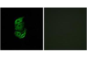 Immunofluorescence analysis of A549 cells, using STA13 Antibody. (STARD13 抗体  (AA 101-150))