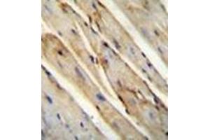 Immunohistochemistry (Paraffin-embedded Sections) (IHC (p)) image for anti-Growth Arrest-Specific 1 (GAS1) (AA 102-136), (N-Term) antibody (ABIN952461)