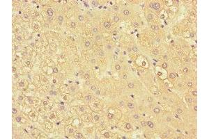 Immunohistochemistry of paraffin-embedded human liver tissue using ABIN7157503 at dilution of 1:100 (KIR2DL3 抗体  (AA 22-245))