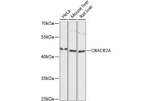 Western blot analysis of extracts of various cell lines, using CRA antibody (ABIN6132088, ABIN6139000, ABIN6139002 and ABIN6217974) at 1:3000 dilution. (EFCAB4B 抗体  (AA 1-200))