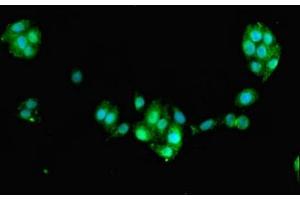 Immunofluorescent analysis of PC-3 cells using ABIN7160449 at dilution of 1:100 and Alexa Fluor 488-congugated AffiniPure Goat Anti-Rabbit IgG(H+L) (FAM168B 抗体  (AA 43-100))