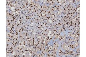 IHC analysis of MSH2 using anti-MSH2 antibody (ABIN7601369). (MSH2 抗体  (AA 337-583))