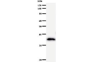 Western Blotting (WB) image for anti-Nucleoporin 93kDa (NUP93) antibody (ABIN931082) (NUP93 抗体)
