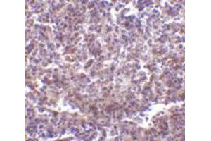 Immunohistochemistry of CD180 in human spleen tissue with CD180 polyclonal antibody  at 2 ug/mL . (CD180 抗体  (N-Term))