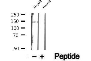 Western blot analysis of extracts of HepG2 cells, using DHX38 antibody. (DHX38 抗体  (C-Term))