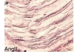 Immunohistochemistry (IHC) image for anti-Angiotensin II (Ang II) antibody (ABIN670521)