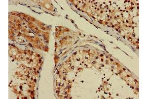 Immunohistochemistry of paraffin-embedded human testis tissue using ABIN7154122 at dilution of 1:100 (GSTT1 抗体  (AA 2-240))