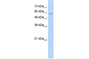 Western Blotting (WB) image for anti-Solute Carrier Family 22 (Organic Cation Transporter), Member 16 (SLC22A16) antibody (ABIN630397)